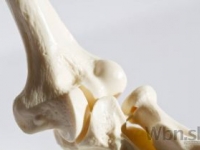 Svetový deň osteoporózy sa tento rok zameria na mužov