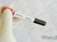 Ľudí s HIV viac trápi stigmatizácia než samotný vírus